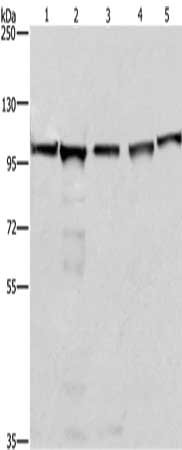 Gel: 10%SDS-PAGE, Lysate: 40 μg, Lane 1-5: 293T cells, A549 cells, Raji cells, K562 cells, NIH/3T3 cells, Primary antibody: MCM6 Antibody(MCM6 Antibody) at dilution 1/433.3, Secondary antibody: Goat anti rabbit IgG at 1/8000 dilution, Exposure time: 5 seconds