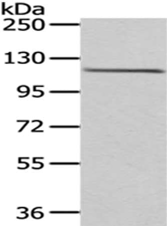 Gel: 6%SDS-PAGE,Lysate: 40 μg,,Primary antibody: WDR36 Antibody(WDR36 Antibody) at dilution 1/200 dilution,Secondary antibody: Goat anti rabbit IgG at 1/8000 dilution,Exposure time: 1 minuteRabbit anti-Human WDR36 Polyclonal Antibody