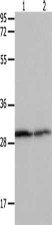 Gel: 12%SDS-PAGE, Lysate: 30 μg, Lane 1-2: Hela cells, mouse kidney tissue, Primary antibody: YWHAB Antibody(YWHAB Antibody) at dilution 1/550, Secondary antibody: Goat anti rabbit IgG at 1/8000 dilution, Exposure time: 10 secondsRabbit anti-Human YWHAB Polyclonal Antibody