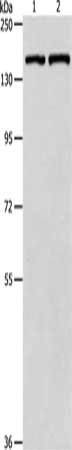 Gel: 8%SDS-PAGE, Lysate: 40 μg, Lane 1-2: Hela cells, mouse lung tissue, Primary antibody: PTCH1 Antibody(PTCH1 Antibody) at dilution 1/900, Secondary antibody: Goat anti rabbit IgG at 1/8000 dilution, Exposure time: 1 minuteRabbit anti-Human PTCH1 Polyclonal Antibody