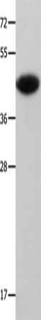 Gel: 12%SDS-PAGE, Lysate: 30 μg, Lane: Mouse muscle tissue, Primary antibody: MAP2K6 Antibody(MAP2K6 Antibody) at dilution 1/500, Secondary antibody: Goat anti rabbit IgG at 1/8000 dilution, Exposure time: 20 seconds
