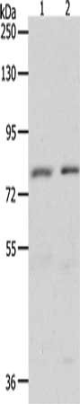 Gel: 8%SDS-PAGE, Lysate: 50 μg, Lane 1-2: Hela cells, HT29 cells, Primary antibody: BRAF Antibody(BRAF Antibody) at dilution 1/1400, Secondary antibody: Goat anti rabbit IgG at 1/8000 dilution, Exposure time: 5 minutes