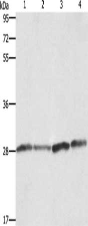 Gel: 10%SDS-PAGE, Lysate: 40 μg, Lane 1-4: Human placenta tissue, A549 cells, Raji cells, hela cells, Primary antibody: BCAP31 Antibody(BCAP31 Antibody) at dilution 1/750, Secondary antibody: Goat anti rabbit IgG at 1/8000 dilution, Exposure time: 1 second
