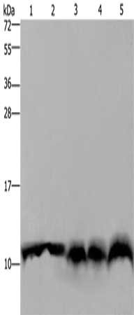 Gel: 10%SDS-PAGE, Lysate: 40 μg, Lane 1-5: Mouse pancreas tissue, Hela cells, mouse liver tissue, A549 cells, 293T cells, Primary antibody: UBB Antibody(UBB Antibody) at dilution 1/500, Secondary antibody: Goat anti rabbit IgG at 1/8000 dilution, Exposure time: 20 secondsRabbit anti-Human UBB Polyclonal Antibody