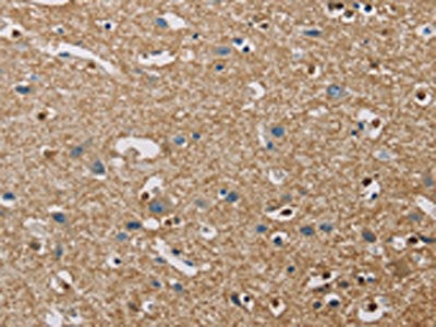 The image on the left is immunohistochemistry of paraffin-embedded Human brain  tissue using PIP4K2A Antibody(PIP4K2A Antibody) at dilution 1/40, on the right is treated with fusion protein. (Original magnification: ×200)Rabbit anti-Human PIP4K2A Polyclonal Antibody