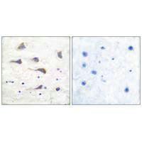 Immunohistochemical analysis of paraffin-embedded human brain tissue using GluR6 antibody.Rabbit anti-Human GRM6 Polyclonal Antibody