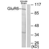 Western blot analysis of extracts from mouse brain, using GluR6 antibody.Rabbit anti-Human GRM6 Polyclonal Antibody