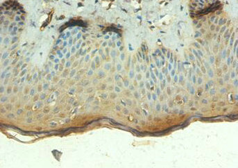 Immunohistochemistry of paraffin-embedded human skin tissue using TEP1 Antibody at dilution of 1:100Rabbit anti-Human TEP1 Polyclonal Antibody