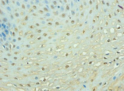 Immunohistochemistry of paraffin-embedded human esophageal tissue using TEP1 Antibody at dilution of 1: 100Rabbit anti-Human TEP1 Polyclonal Antibody