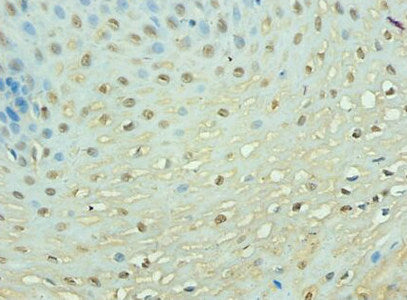 Immunohistochemistry of paraffin-embedded human esophageal tissue using TEP1 Antibody at dilution of 1: 100Rabbit anti-Human TEP1 Polyclonal Antibody