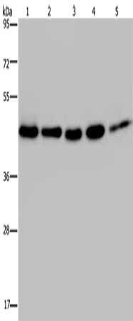 Gel: 8%SDS-PAGE, Lysate: 40 μg, Lane 1-5: 231 cells, A431 cells, Raji cells, Jurkat cells, HepG2 cells, Primary antibody: DNAJA1 Antibody(DNAJA1 Antibody) at dilution 1/500, Secondary antibody: Goat anti rabbit IgG at 1/8000 dilution, Exposure time: 5 secondsRabbit anti-Human DNAJA1 Polyclonal Antibody