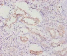 Immunohistochemistry of paraffin-embedded human kidney tissue using CASP8 Antibody at dilution of 1:20