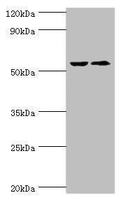Western blot  | All lanes: CASP8 antibody at 2µg/ml  | Lane 1: ACCM whole cell lysate  | Lane 2: LO2 whole cell lysate  | Secondary  | Goat polyclonal to rabbit IgG at 1/10000 dilution  | Predicted band size: 56, 54, 46, 58, 28, 26, 33, 31, 62 kDa  | Observed band size: 56 kDa