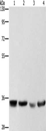 Gel: 8%SDS-PAGE, Lysate: 40 μg, Lane 1-4: Hela cells, hepG2 cells, A549 cells, 293T cells, Primary antibody: AIMP1 Antibody(AIMP1 Antibody) at dilution 1/400, Secondary antibody: Goat anti rabbit IgG at 1/8000 dilution, Exposure time: 1 secondRabbit anti-Human AIMP1 Polyclonal Antibody
