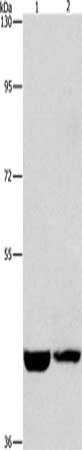 Gel: 10%SDS-PAGE, Lysate: 40 μg, Lane 1-2: Hela cells, A431 cells, Primary antibody: CSNK1E Antibody(CSNK1E Antibody) at dilution 1/1550, Secondary antibody: Goat anti rabbit IgG at 1/8000 dilution, Exposure time: 1 minuteRabbit anti-Human CSNK1E Polyclonal Antibody