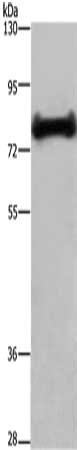 Gel: 6%SDS-PAGE, Lysate: 40 μg, Lane: Mouse liver tissue, Primary antibody: EHHADH Antibody(EHHADH Antibody) at dilution 1/200, Secondary antibody: Goat anti rabbit IgG at 1/8000 dilution, Exposure time: 1 minuteRabbit anti-Human EHHADH Polyclonal Antibody