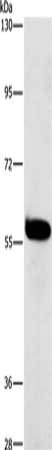 Gel: 8%SDS-PAGE, Lysate: 40 μg, Lane: A549 cells, Primary antibody: HCK Antibody(HCK Antibody) at dilution 1/450, Secondary antibody: Goat anti rabbit IgG at 1/8000 dilution, Exposure time: 15 secondsRabbit anti-Human HCK Polyclonal Antibody