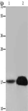 Gel: 8%SDS-PAGE, Lysate: 40 μg, Lane 1-2: Mouse kidney tissue, human kidney tissue, Primary antibody: FHIT Antibody(FHIT Antibody) at dilution 1/600, Secondary antibody: Goat anti rabbit IgG at 1/8000 dilution, Exposure time: 20 secondsRabbit anti-Human FHIT Polyclonal Antibody