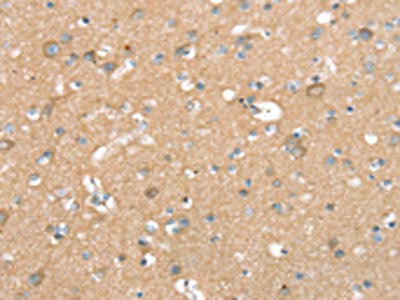 The image on the left is immunohistochemistry of paraffin-embedded Human brain tissue using SEPN1 Antibody(SEPN1 Antibody) at dilution 1/20, on the right is treated with synthetic peptide. (Original magnification: ×200)Rabbit anti-Human SEPN1 Polyclonal Antibody