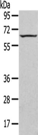 Gel: 8%SDS-PAGE,Lysate: 40 μg,,Primary antibody: SEPN1 Antibody(SEPN1 Antibody) at dilution 1/200 dilution,Secondary antibody: Goat anti rabbit IgG at 1/8000 dilution,Exposure time: 10 minutesRabbit anti-Human SEPN1 Polyclonal Antibody