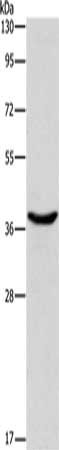 Gel: 15%SDS-PAGE, Lysate: 40 μg, Lane: 293T cells, Primary antibody: DNAJB1 Antibody(DNAJB1 Antibody) at dilution 1/750, Secondary antibody: Goat anti rabbit IgG at 1/8000 dilution, Exposure time: 1 secondRabbit anti-Human DNAJB1 Polyclonal Antibody