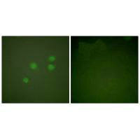Immunofluorescence analysis of A549 cells, using Cyclin E1 antibody.Rabbit anti-Human CCNE1 Polyclonal Antibody