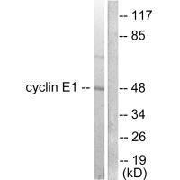 Western blot analysis of extracts from K562 cells, using Cyclin E1 antibody.Rabbit anti-Human CCNE1 Polyclonal Antibody