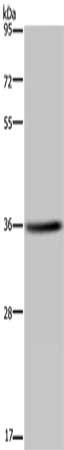 Gel: 8%SDS-PAGE, Lysate: 40 μg, Lane: LO2 cells, Primary antibody: KCNK17 Antibody(KCNK17 Antibody) at dilution 1/300, Secondary antibody: Goat anti rabbit IgG at 1/8000 dilution, Exposure time: 10 seconds