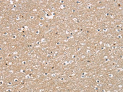 The image on the left is immunohistochemistry of paraffin-embedded Human brain  tissue using DMRT3 Antibody(DMRT3 Antibody) at dilution 1/25, on the right is treated with fusion protein. (Original magnification: ×200)Rabbit anti-Human DMRT3 Polyclonal Antibody