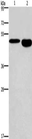 Gel: 8%SDS-PAGE, Lysate: 40 μg, Lane 1-2: Mouse stomach tissue, Mouse brain tissue, Primary antibody: DMRT3 Antibody(DMRT3 Antibody) at dilution 1/550, Secondary antibody: Goat anti rabbit IgG at 1/8000 dilution, Exposure time: 40 secondsRabbit anti-Human DMRT3 Polyclonal Antibody