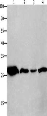 Gel: 10+12%SDS-PAGE, Lysate: 40 μg, Lane 1-4: Mouse brain tissue, A549 cells, human lymphoma tissue, hela cells, Primary antibody: YWHAQ Antibody(YWHAQ Antibody) at dilution 1/950, Secondary antibody: Goat anti rabbit IgG at 1/8000 dilution, Exposure time: 1 minuteRabbit anti-Human YWHAQ Polyclonal Antibody