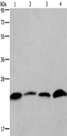 Gel: 10%SDS-PAGE,Lysate: 40 μg,Lane 1-4: Human placenta tissue, Human testis tissue, Hela cells, Raji cells,Primary antibody: CMTM6 Antibody(CMTM6 Antibody) at dilution 1/700 dilution,Secondary antibody: Goat anti rabbit IgG at 1/8000 dilution,Exposure time: 3 minutesRabbit anti-Human CMTM6 Polyclonal Antibody