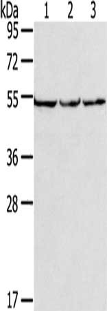 Gel: 8%SDS-PAGE, Lysate: 40 μg, Lane 1-3: PC3 cells, hela cells, A549 cells, Primary antibody: MMP23A Antibody(MMP23B Antibody) at dilution 1/200, Secondary antibody: Goat anti rabbit IgG at 1/8000 dilution, Exposure time: 10 secondsRabbit anti-Human MMP23A Polyclonal Antibody