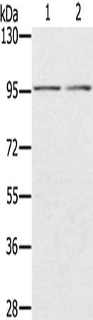 Gel: 6%SDS-PAGE, Lysate: 40 μg, Lane 1-2: PC3 cells, human fetal liver tissue, Primary antibody: PYGL Antibody(PYGL Antibody) at dilution 1/300, Secondary antibody: Goat anti rabbit IgG at 1/8000 dilution, Exposure time: 30 secondsRabbit anti-Human PYGL Polyclonal Antibody