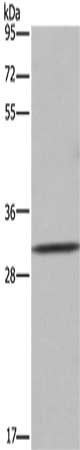 Gel: 8%SDS-PAGE, Lysate: 50 μg, Lane: 231 cells, Primary antibody: ASGR1 Antibody(ASGR1 Antibody) at dilution 1/300, Secondary antibody: Goat anti rabbit IgG at 1/8000 dilution, Exposure time: 1 minuteRabbit anti-Human ASGR1 Polyclonal Antibody