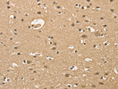 The image on the left is immunohistochemistry of paraffin-embedded Human brain  tissue using ALDH8A1 Antibody(ALDH8A1 Antibody) at dilution 1/30, on the right is treated with fusion protein. (Original magnification: ×200)Rabbit anti-Human ALDH8A1 Polyclonal Antibody
