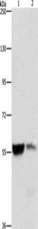 Gel: 8%SDS-PAGE, Lysate: 40 μg, Lane 1-2: Mouse liver tissue, Mouse kidney tissue, Primary antibody: ALDH8A1 Antibody(ALDH8A1 Antibody) at dilution 1/550, Secondary antibody: Goat anti rabbit IgG at 1/8000 dilution, Exposure time: 3 secondsRabbit anti-Human ALDH8A1 Polyclonal Antibody