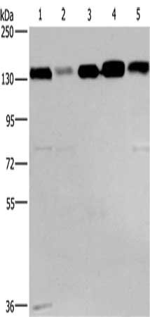 Gel: 6%SDS-PAGE, Lysate: 40 μg, Lane 1-5: 293T cells, hela cells, PC3 cells, lovo cells, A172 cells, Primary antibody: CEP97 Antibody(CEP97 Antibody) at dilution 1/500, Secondary antibody: Goat anti rabbit IgG at 1/8000 dilution, Exposure time: 30 secondsRabbit anti-Human CEP97 Polyclonal Antibody