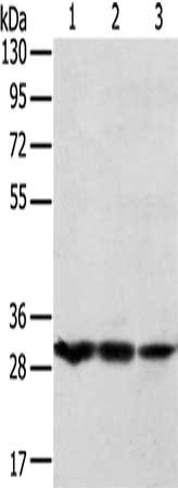 Gel: 8%SDS-PAGE, Lysate: 40 μg, Lane 1-3: Mouse bladder tissue, K562 cells, MCF7 cells, Primary antibody: TPD52L2 Antibody(TPD52L2 Antibody) at dilution 1/250, Secondary antibody: Goat anti rabbit IgG at 1/8000 dilution, Exposure time: 1 minuteRabbit anti-Human TPD52L2 Polyclonal Antibody