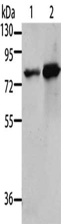 Gel: 10%SDS-PAGE, Lysate: 40 μg, Lane 1-2: 293T cells, A431 cells, Primary antibody: MSN Antibody(MSN Antibody) at dilution 1/500, Secondary antibody: Goat anti rabbit IgG at 1/8000 dilution, Exposure time: 1 minuteRabbit anti-Human MSN Polyclonal Antibody