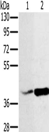 Gel: 8%SDS-PAGE, Lysate: 40 μg, Lane 1-2: Hela cells, A549 cells, Primary antibody: NDUFA10 Antibody(NDUFA10 Antibody) at dilution 1/500, Secondary antibody: Goat anti rabbit IgG at 1/8000 dilution, Exposure time: 5 minutesRabbit anti-Human NDUFA10 Polyclonal Antibody