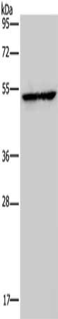 Gel: 8%SDS-PAGE, Lysate: 40 μg, Lane: Human fetal liver tissue, Primary antibody: HMGCS2 Antibody(HMGCS2 Antibody) at dilution 1/300, Secondary antibody: Goat anti rabbit IgG at 1/8000 dilution, Exposure time: 30 secondsRabbit anti-Human HMGCS2 Polyclonal Antibody