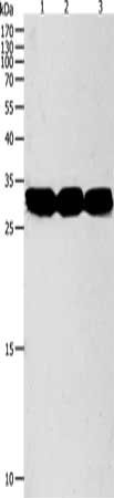 Gel: 10%SDS-PAGE, Lysate: 40 μg, Lane 1-3: Mouse liver tissue, Mouse kidney tissue, RAW264.7 cells, Primary antibody: NIT2 Antibody(NIT2 Antibody) at dilution 1/950, Secondary antibody: Goat anti rabbit IgG at 1/8000 dilution, Exposure time: 90 secondsRabbit anti-Human NIT2 Polyclonal Antibody