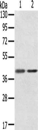 Gel: 8%SDS-PAGE, Lysate: 40 μg, Lane 1-2: Raw264.7, TM4 cells, Primary antibody: STX18 Antibody(STX18 Antibody) at dilution 1/350, Secondary antibody: Goat anti rabbit IgG at 1/8000 dilution, Exposure time: 20 secondsRabbit anti-Human STX18 Polyclonal Antibody