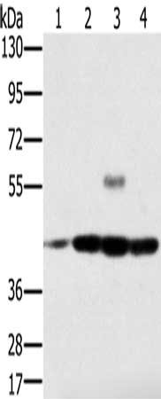 Gel: 8%SDS-PAGE, Lysate: 40 μg, Lane 1-4: Jurkat cells, Raji cells, K562 cells, hela cells, Primary antibody: PAICS Antibody(PAICS Antibody) at dilution 1/400, Secondary antibody: Goat anti rabbit IgG at 1/8000 dilution, Exposure time: 20 secondsRabbit anti-Human PAICS Polyclonal Antibody