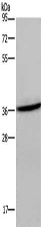 Gel: 8%SDS-PAGE, Lysate: 40 μg, Lane: Mouse brain tissue, Primary antibody: CXCR6 Antibody(CXCR6 Antibody) at dilution 1/400, Secondary antibody: Goat anti rabbit IgG at 1/8000 dilution, Exposure time: 2 minutes