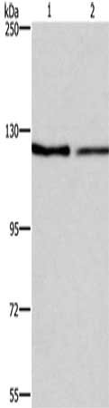 Gel: 6%SDS-PAGE, Lysate: 40 μg, Lane 1-2: NIH/3T3 cells, LoVo cells, Primary antibody: ATP2A1 Antibody(ATP2A1 Antibody) at dilution 1/500, Secondary antibody: Goat anti rabbit IgG at 1/8000 dilution, Exposure time: 3 minutesRabbit anti-Human ATP2A1 Polyclonal Antibody