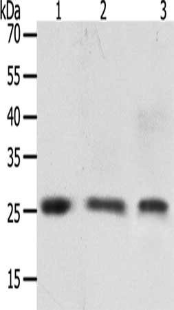 Gel: 8+12%SDS-PAGE, Lysate: 50 μg, Lane 1-3: Human brain tissue, PC3 cells, hela cells, Primary antibody: TIMP4 Antibody(TIMP4 Antibody) at dilution 1/200, Secondary antibody: Goat anti rabbit IgG at 1/8000 dilution, Exposure time: 30 secondsRabbit anti-Human TIMP4 Polyclonal Antibody