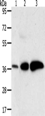 Gel: 10%SDS-PAGE, Lysate: 27 μg, Lane 1-3: Human liver cancer tissue, Human breast infiltrative duct tissue, human fetal brain tissue, Primary antibody: AKR1C1 Antibody(AKR1C1 Antibody) at dilution 1/500, Secondary antibody: Goat anti rabbit IgG at 1/8000 dilution, Exposure time: 2 minutesRabbit anti-Human AKR1C1 Polyclonal Antibody