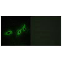 Immunofluorescence analysis of HeLa cells, using TRI18 antibody.